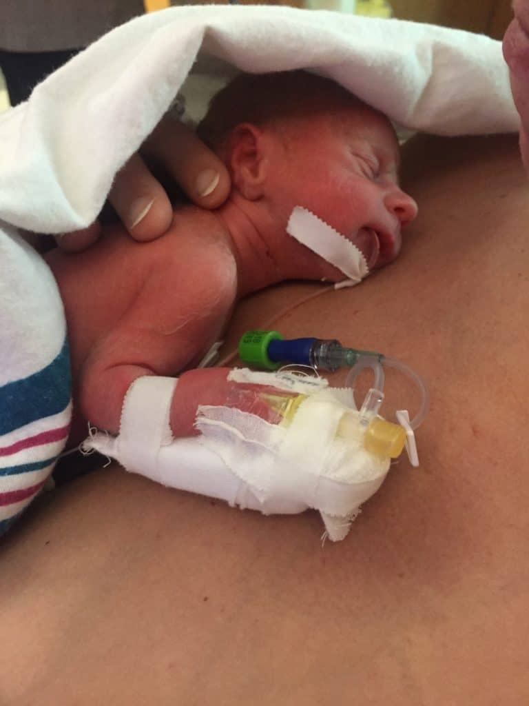 preemie babies do well when they get kangaroo care with lovedones getting skin to skin contact which helps regulate their temperature in the NICU NICU grad Preemie baby in kangaroo care